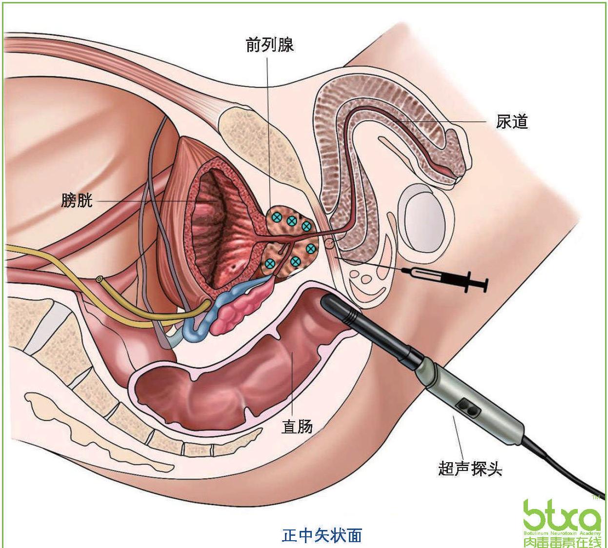 三、治療
